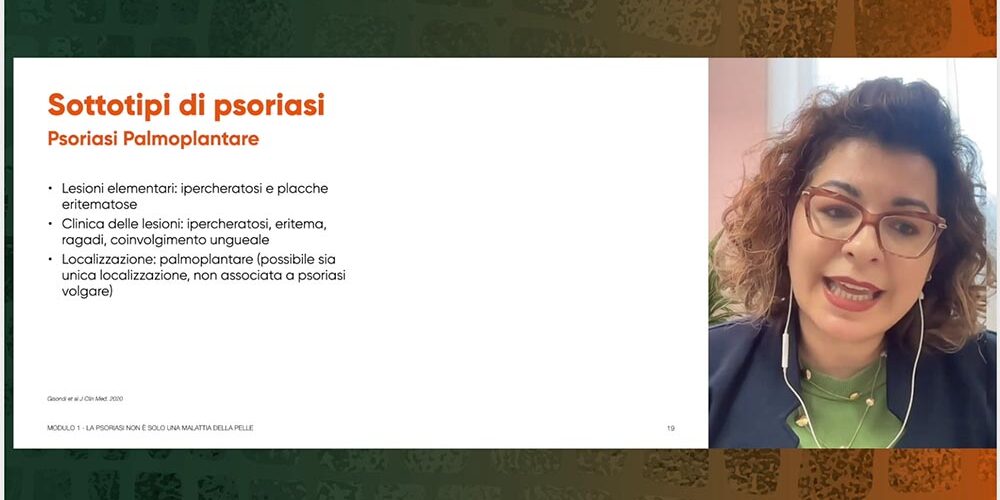 Patient Journey nella psoriasi a placche lieve-moderata