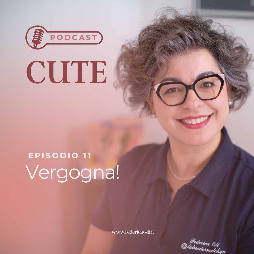 Vergogna